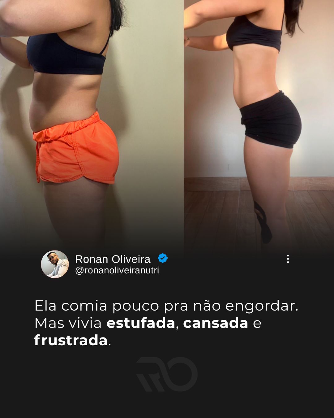 Transformação - Ela comia pouco pra não engordar, mas vivia estufada, cansada e frustrada