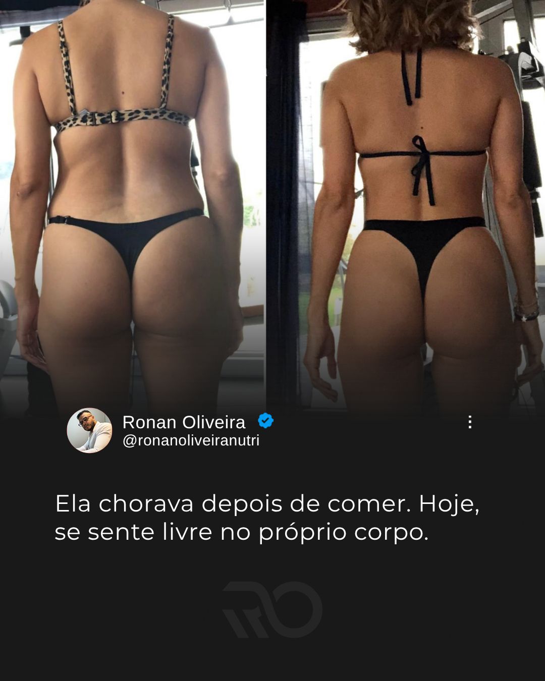 Ela chorava depois de comer. Hoje, se sente livre no próprio corpo